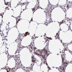 ZNF221 Antibody, Novus Biologicals 0.1mL; Unlabeled:Antibodies, Polyclonal
